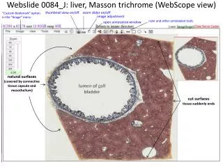Webslide 0084_J: liver, Masson trichrome ( WebScope view)