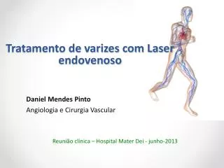 Tratamento de varizes com Laser endovenoso