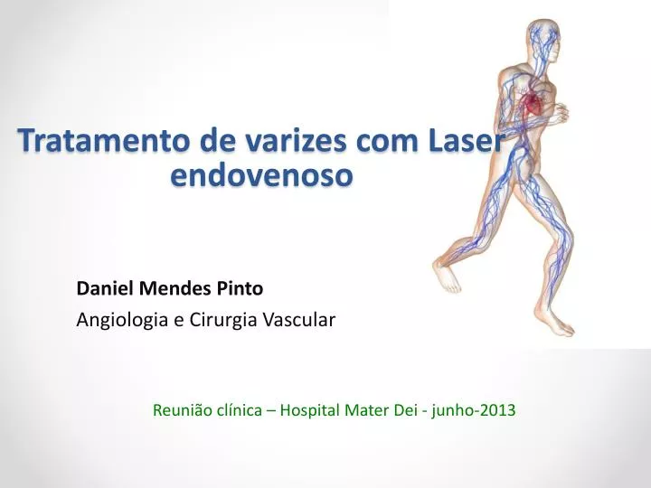tratamento de varizes com laser endovenoso