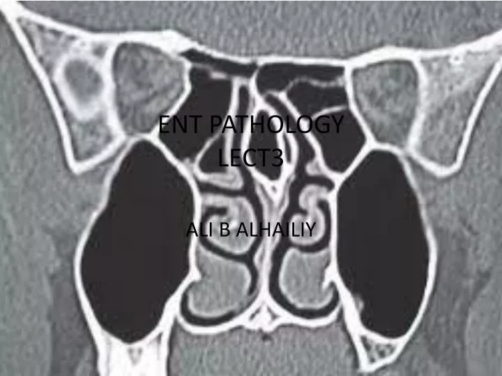 ent pathology lect3