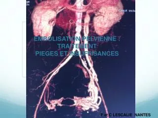 embolisation pelvienne traitement pieges et insuffisances