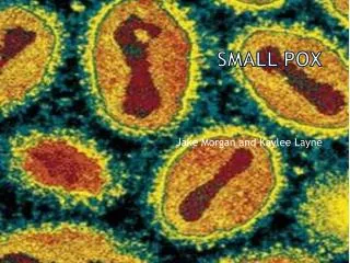 Small Pox