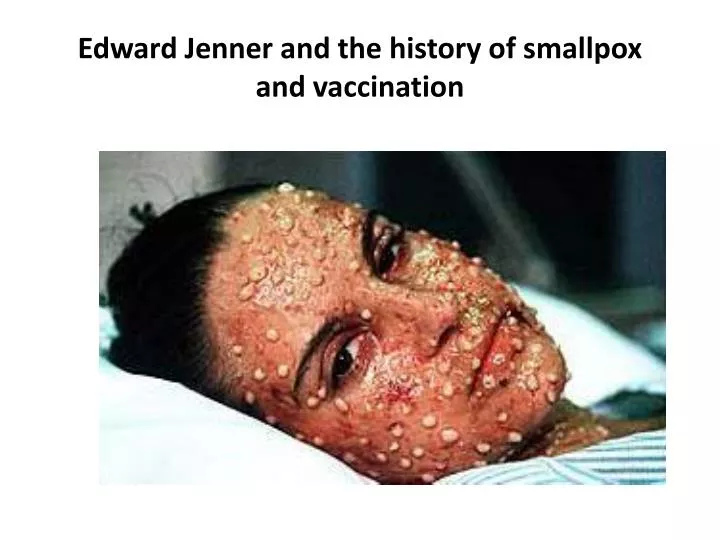 edward jenner and the history of smallpox and vaccination