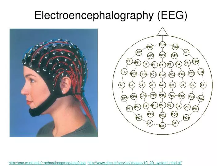 electroencephalography eeg