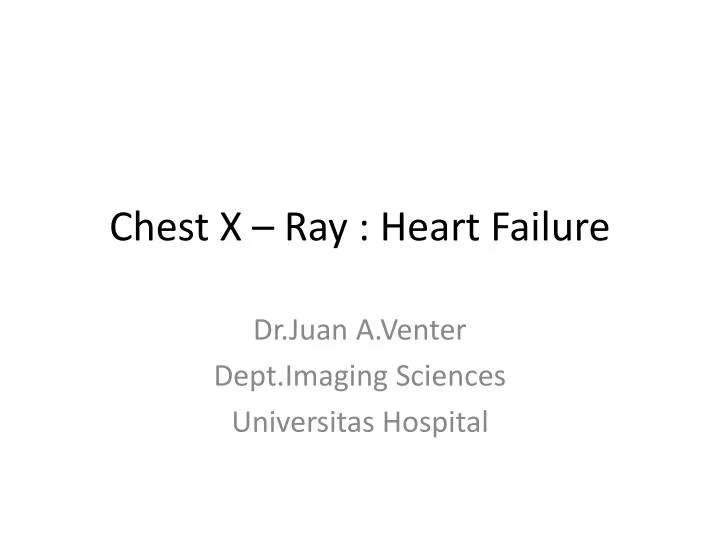 chest x ray heart failure