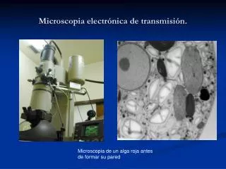 microscopia electr nica de transmisi n
