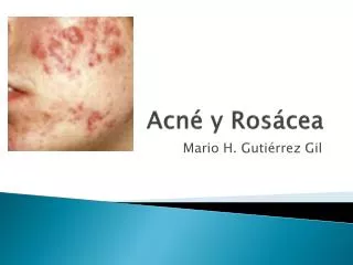 acn y ros cea