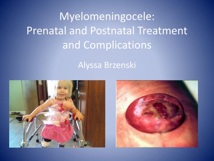 myelomeningocele prenatal and postnatal treatment and complications