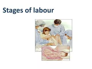 Stages of labour