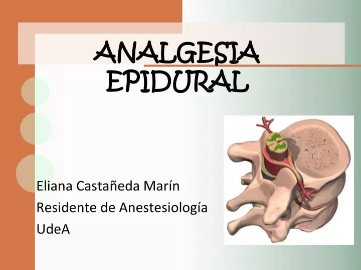 analgesia epidural