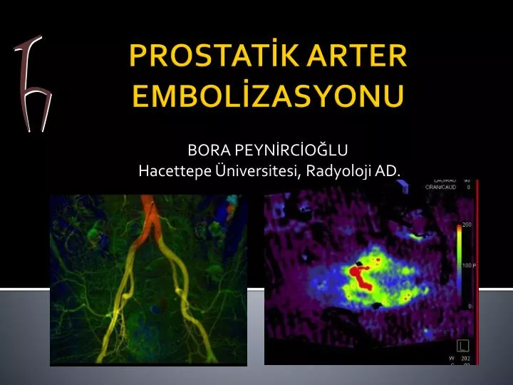 bora peyn rc o lu hacettepe niversitesi radyoloji ad