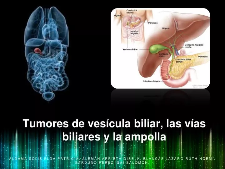 tumores de ves cula biliar las v as biliares y la ampolla