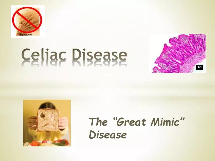 celiac disease