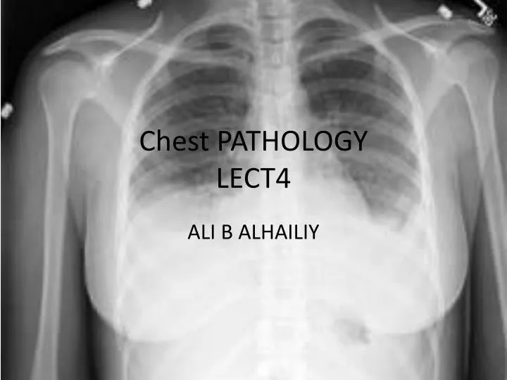 chest pathology lect4
