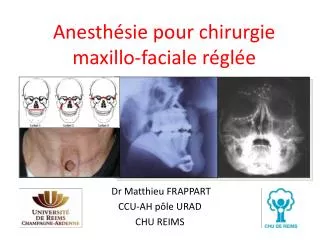 anesth sie pour chirurgie maxillo faciale r gl e