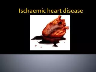 Ischaemic heart disease