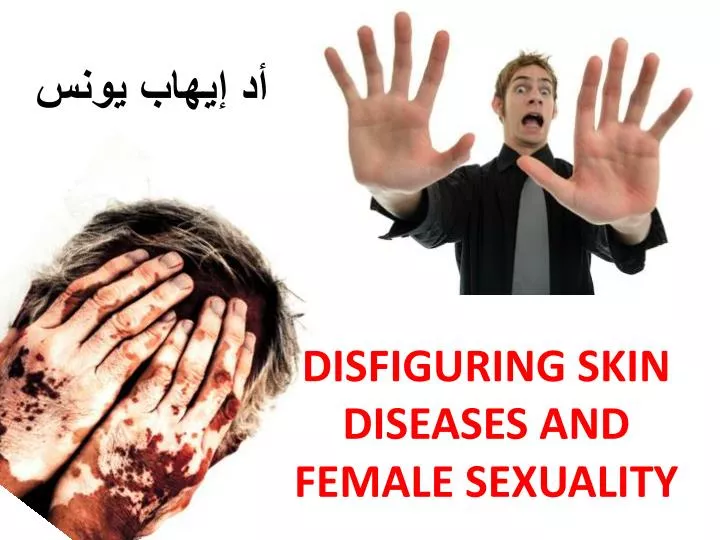 disfiguring skin diseases and female sexuality