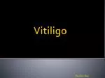 Vitiligo - slide 1