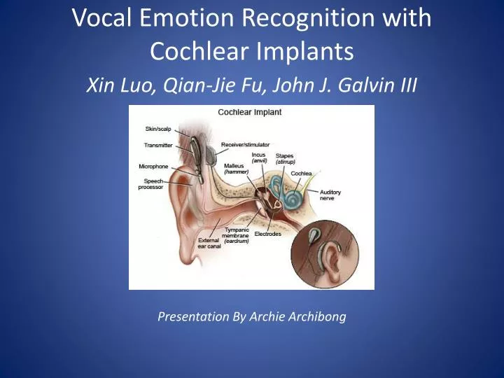 vocal emotion recognition with cochlear implants