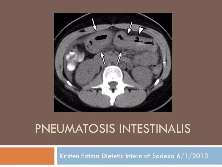 pneumatosis intestinalis