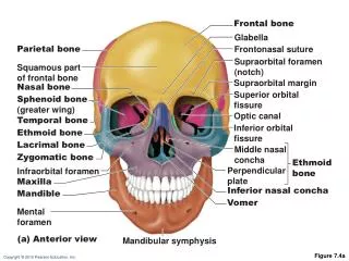 Figure 7.4a