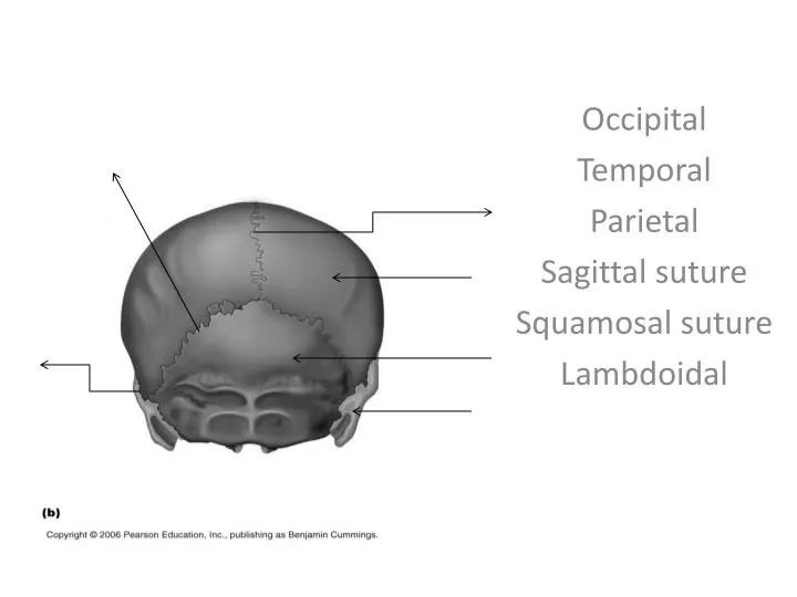 occipital temporal parietal sagittal suture squamosal suture lambdoidal