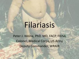 Filariasis