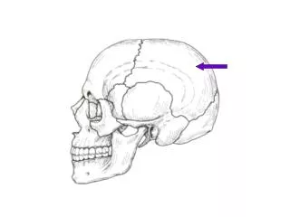 Left Parietal Bone
