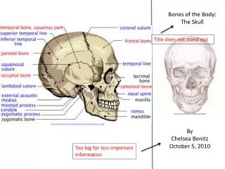 Bones of the Body: The Skull