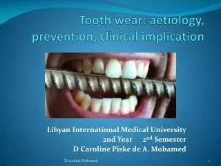 Tooth wear: aetiology , prevention, clinical implication