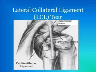 Lateral Collateral Ligament (LCL) Tear
