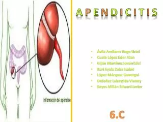 a p e n d i c i t i s
