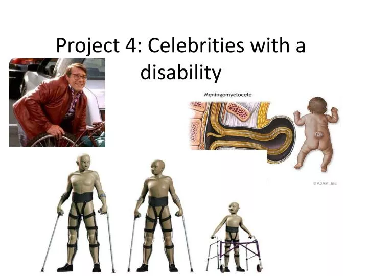 project 4 celebrities with a disability