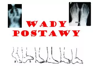 wady postawy