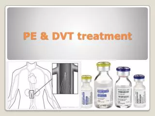 PE &amp; DVT treatment