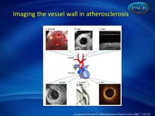 Imaging the vessel wall in atherosclerosis