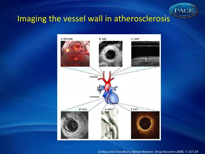 imaging the vessel wall in atherosclerosis