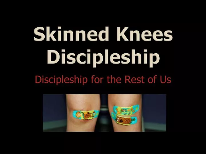 skinned knees discipleship