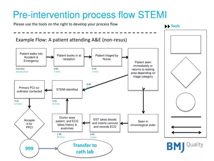 pre intervention process flow stemi