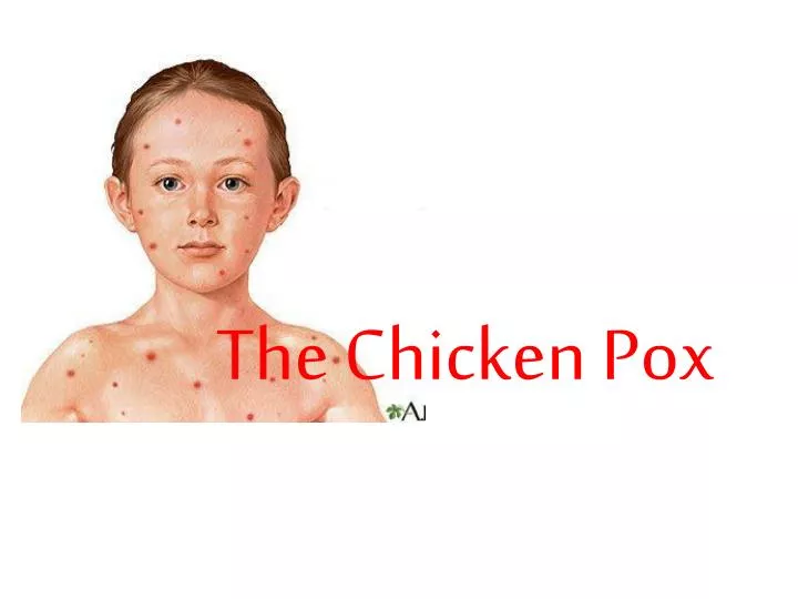 the chicken pox