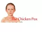 The Chicken Pox