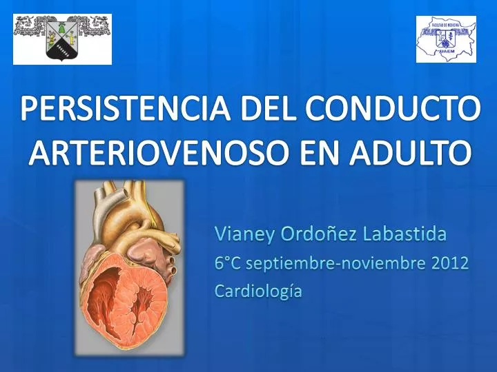 persistencia del conducto arteriovenoso en adulto