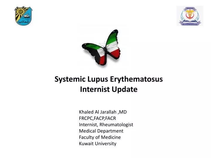 systemic lupus erythematosus internist update