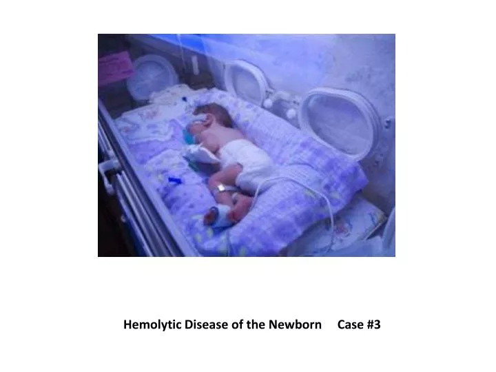 hemolytic disease of the newborn case 3