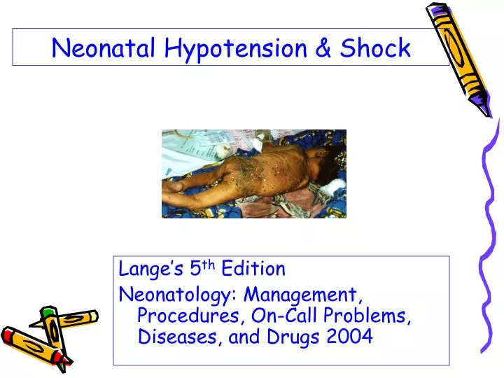 neonatal hypotension shock