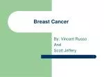 Breast Cancer - slide 1