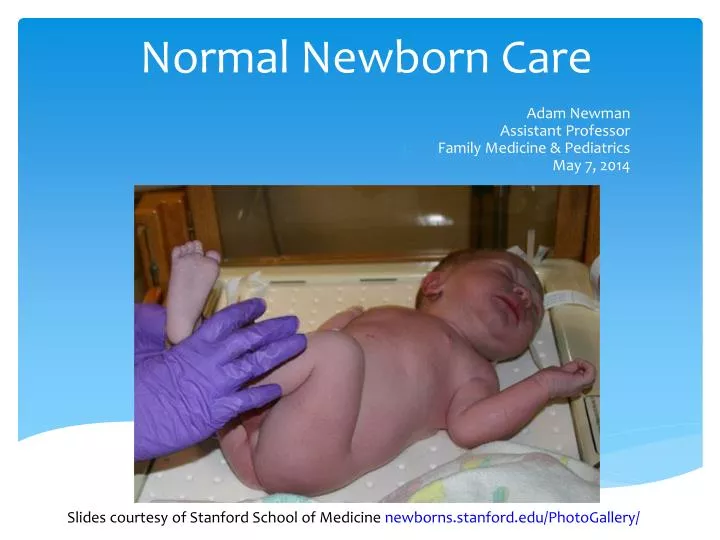 normal newborn care