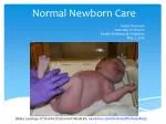Normal Newborn Care - slide 1