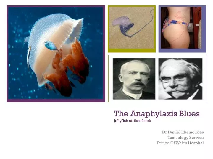 the anaphylaxis blues jellyfish strikes back