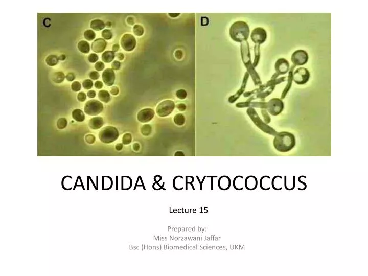candida crytococcus
